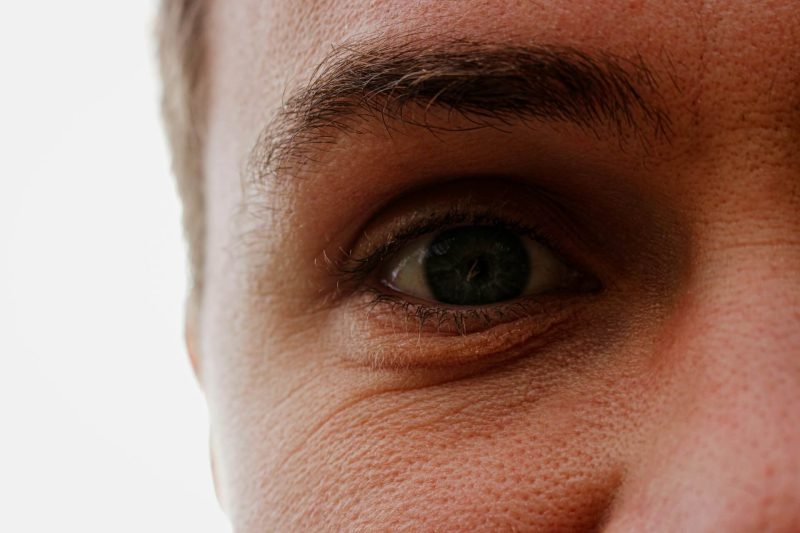 Der Kreuzblick lässt sich gut trainieren